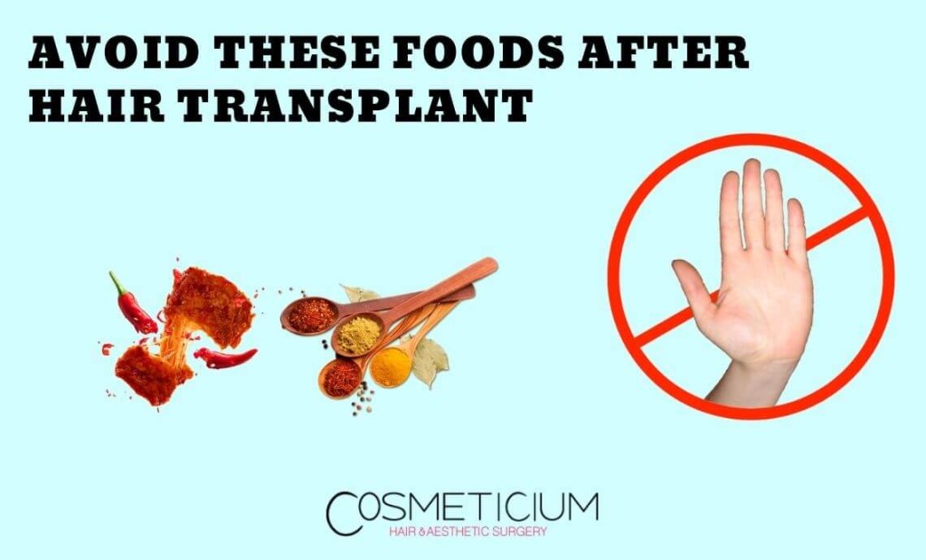 Picture of: Avoid These Foods After Hair Transplantation! – Cosmeticium