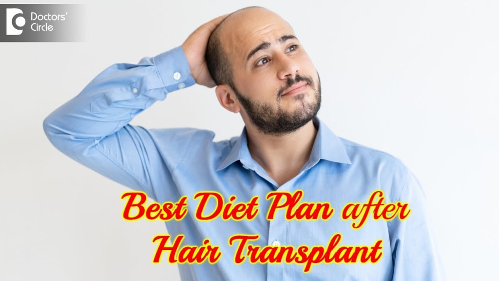 Picture of: HAIR TRANSPLANT DIET  Food restrictions after Hair Transplant-Dr